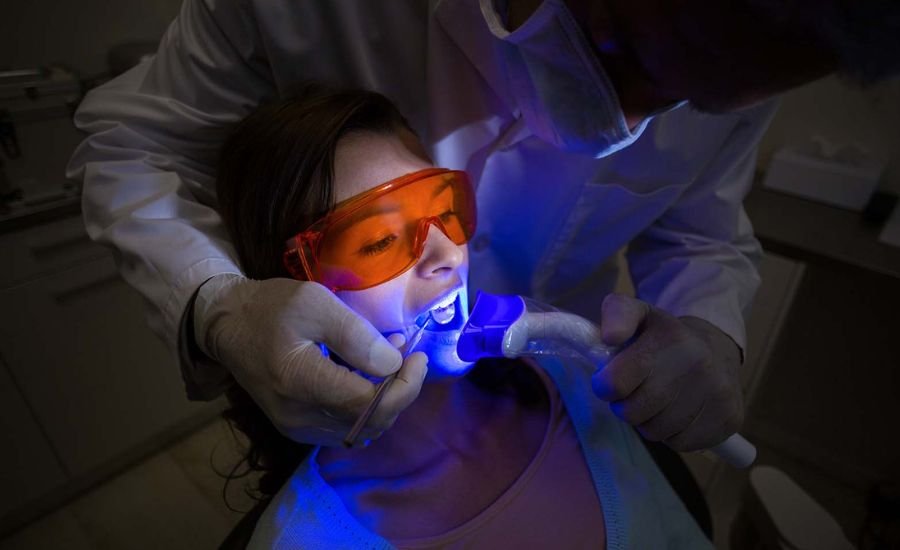 Laser Dentistry